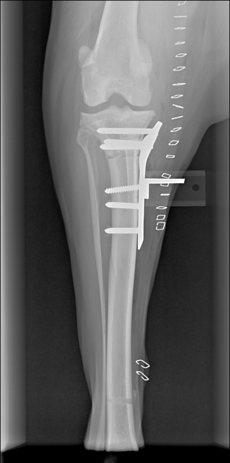 Digital Radiographs