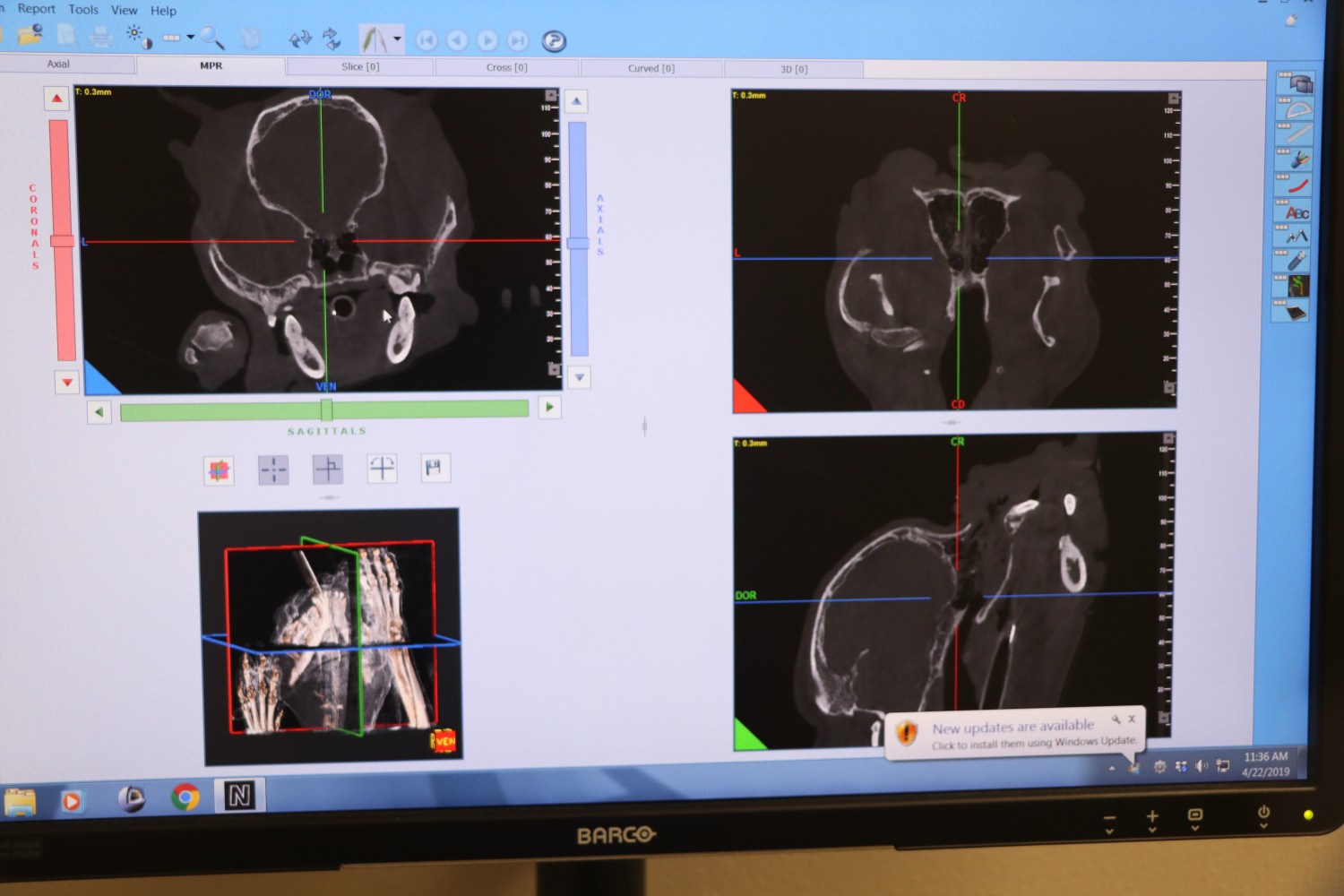 CT Scan