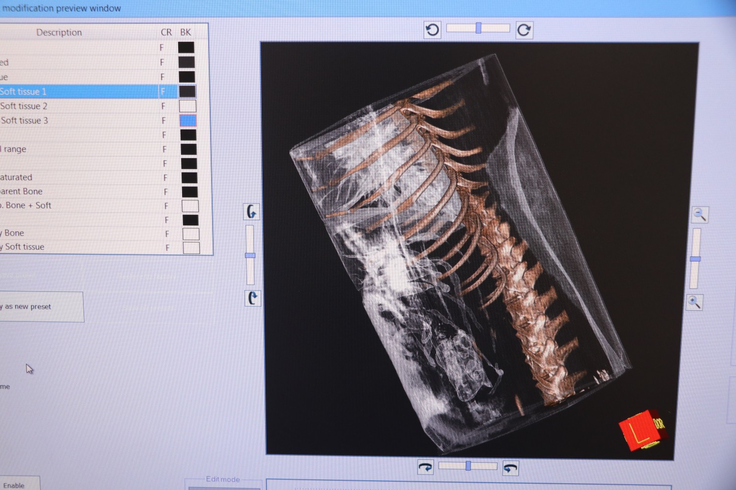 CT Scan CT Scan