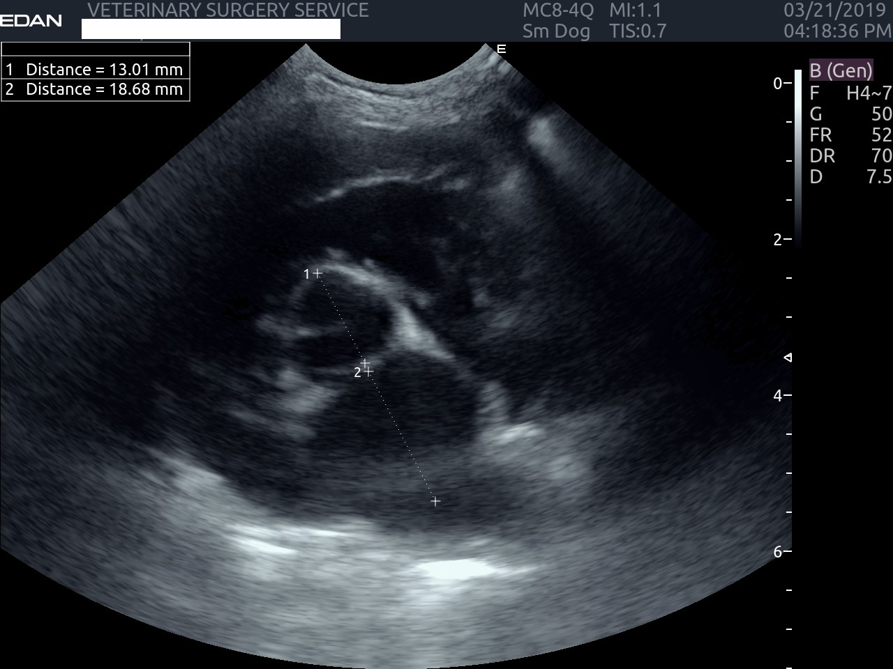 Cardiac Ultrasound (Echocardiogram)