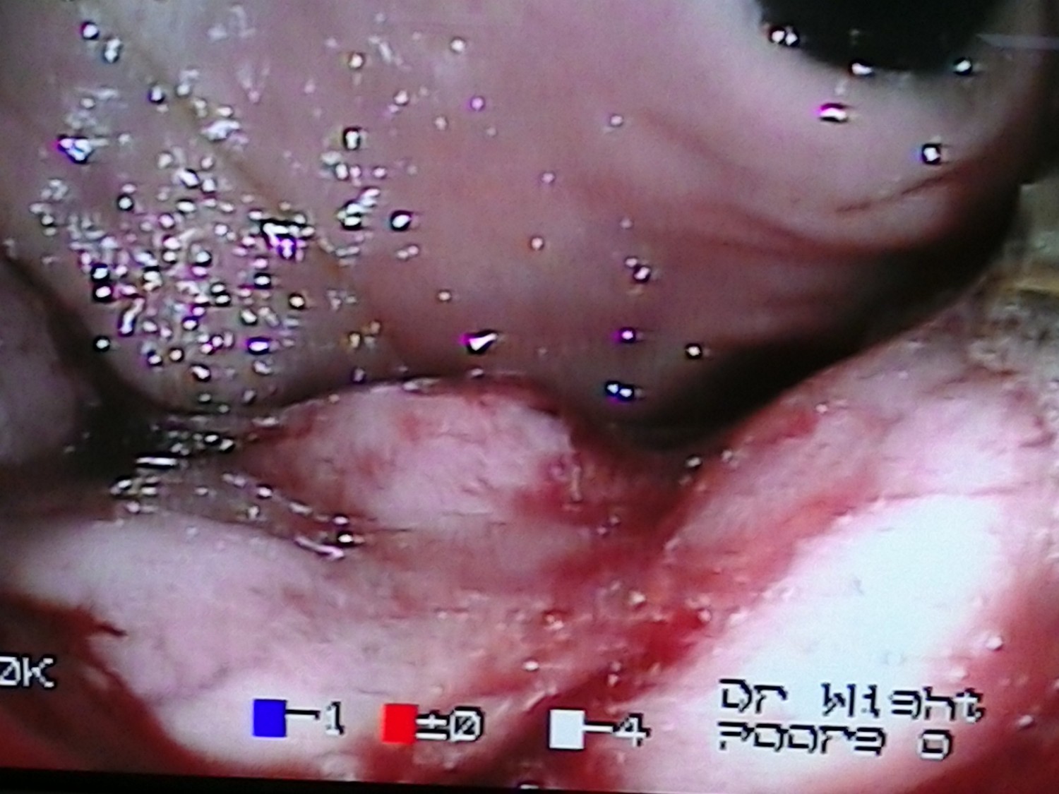 Endoscopy Endoscopy