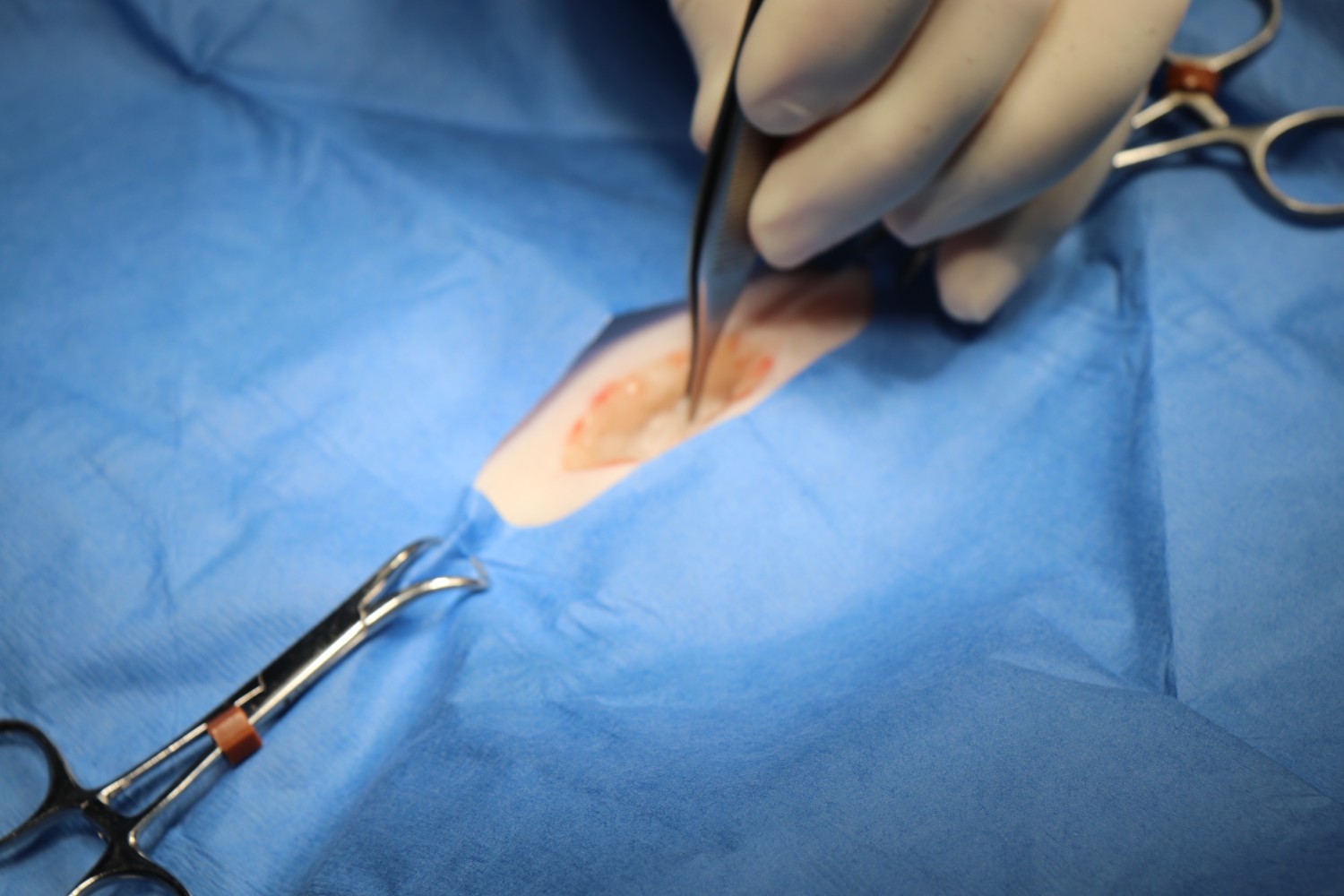 Cystotomy & Urethrostomy Cystotomy & Urethrostomy