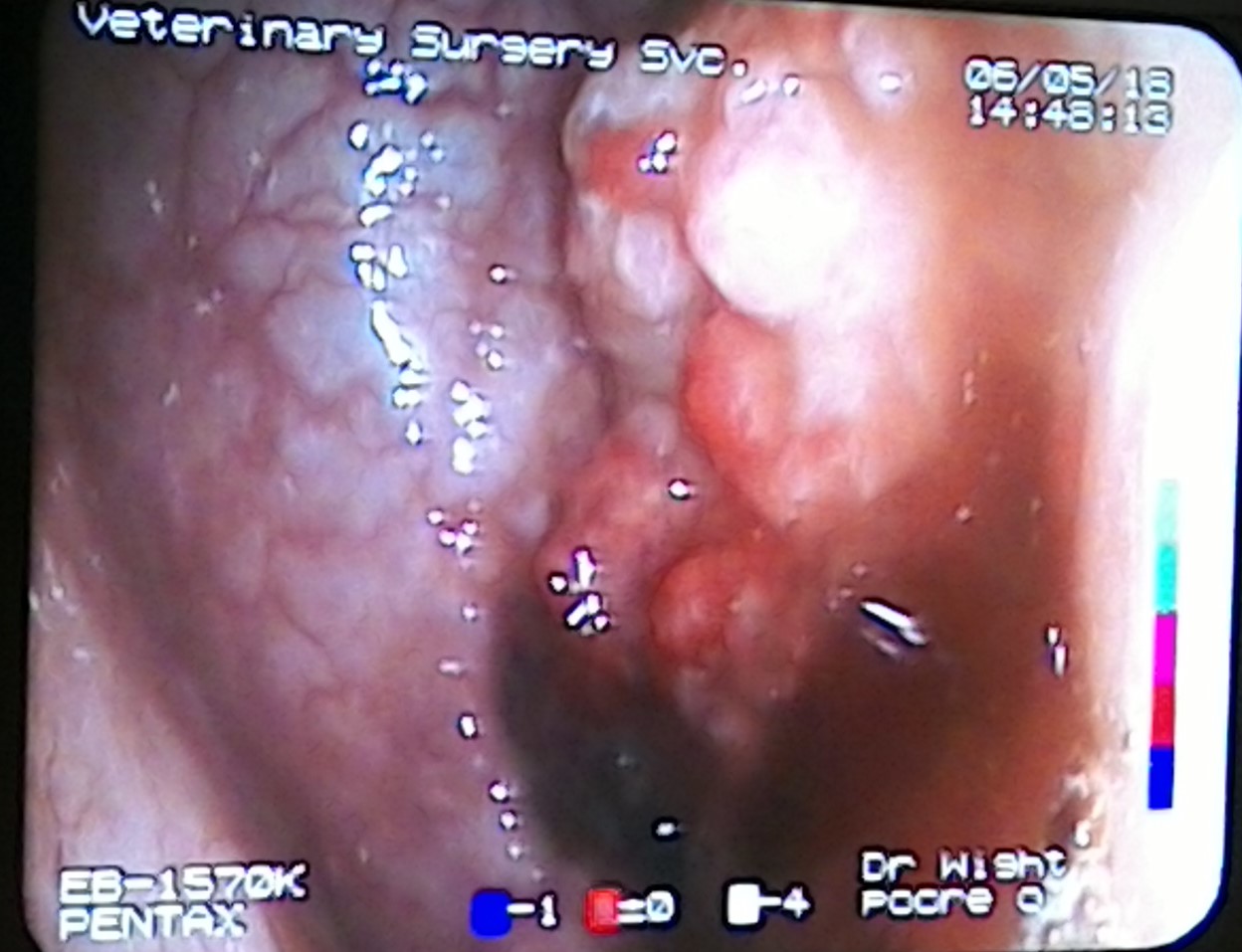 Cystoscopy