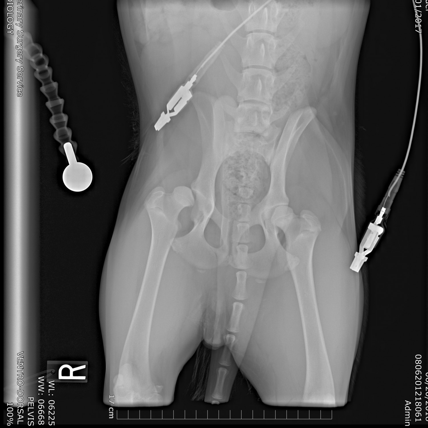 PELVIS_VENTRO-DORSAL PELVIS_VENTRO-DORSAL