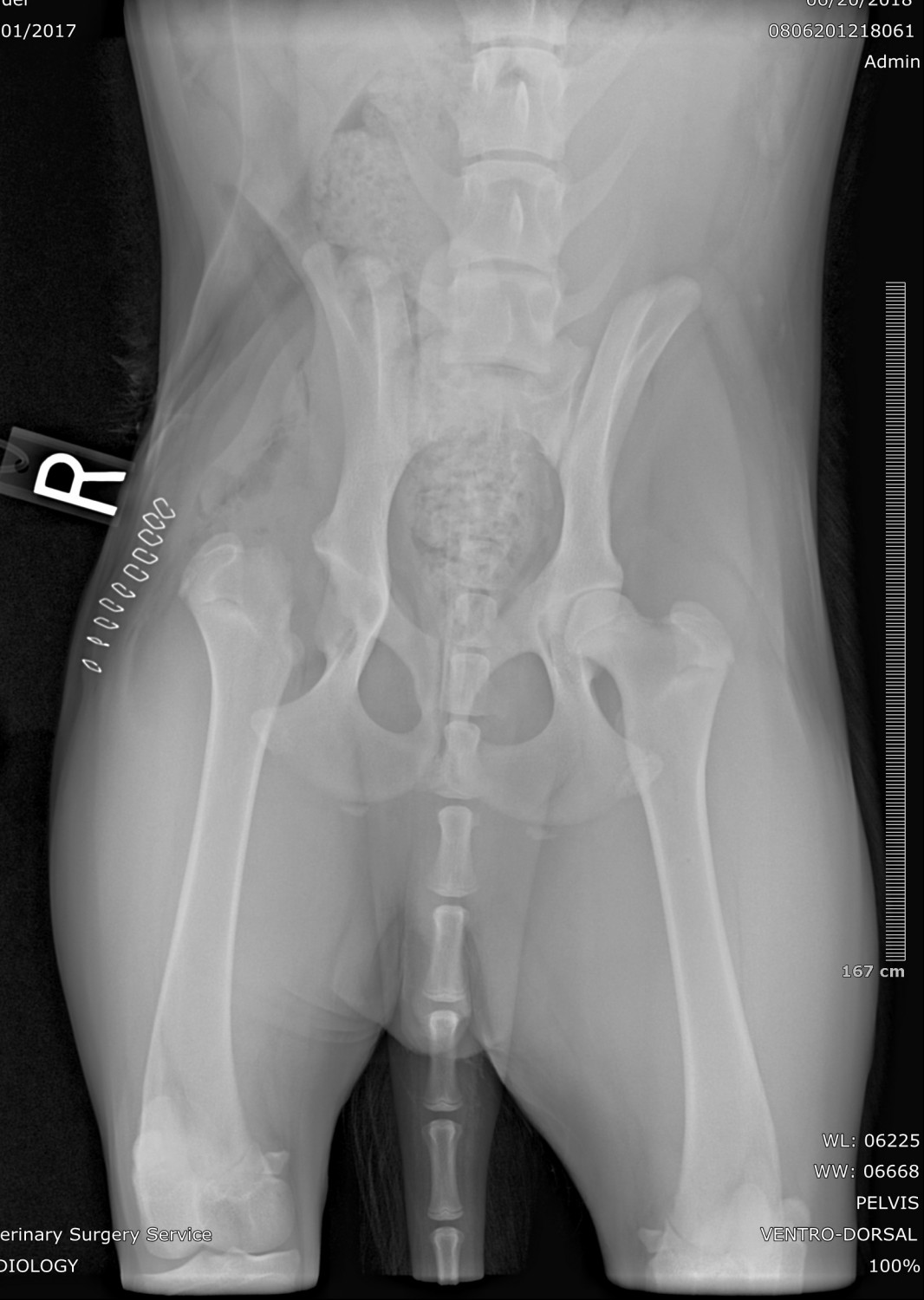 PELVIS_VENTRO-DORSAL PELVIS_VENTRO-DORSAL