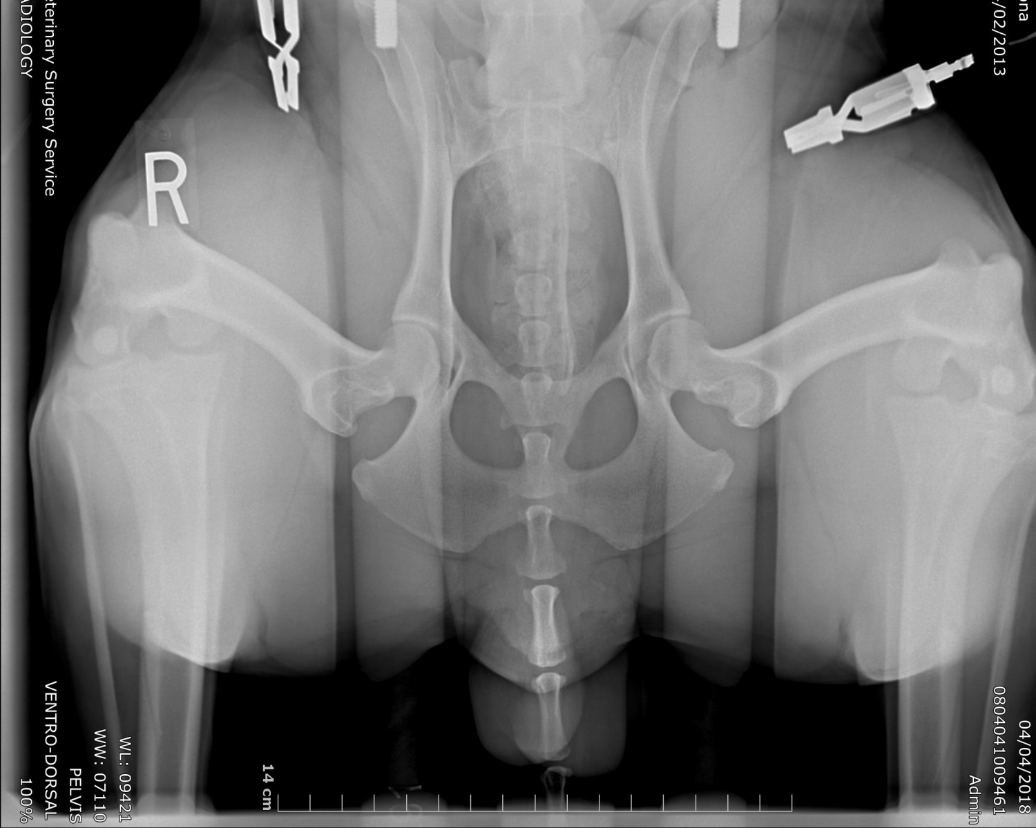 PELVIS_VENTRO-DORSAL PELVIS_VENTRO-DORSAL