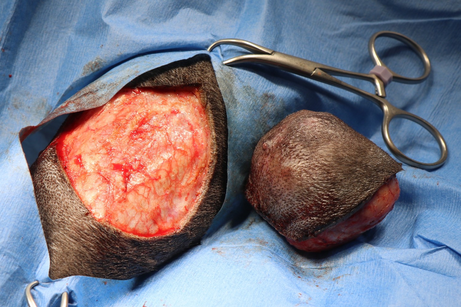 Mass / Tumor Removal Mass / Tumor Removal