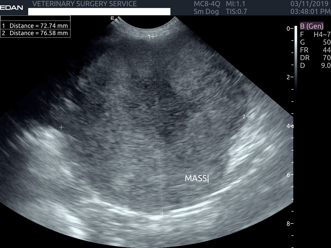 Abdominal Ultrasound